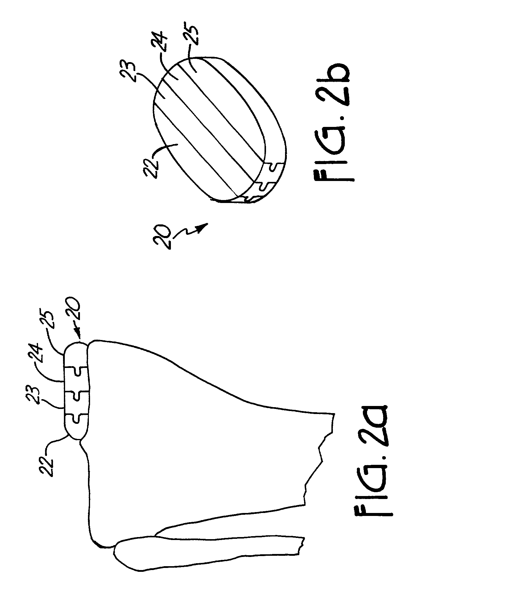 Method and system for mammalian joint resurfacing