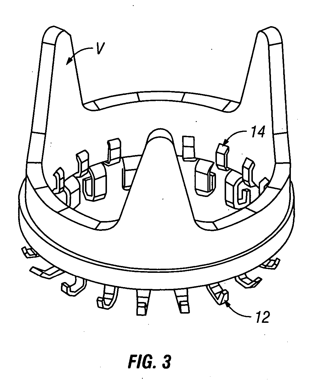 Ring-shaped valve prosthesis attachment device