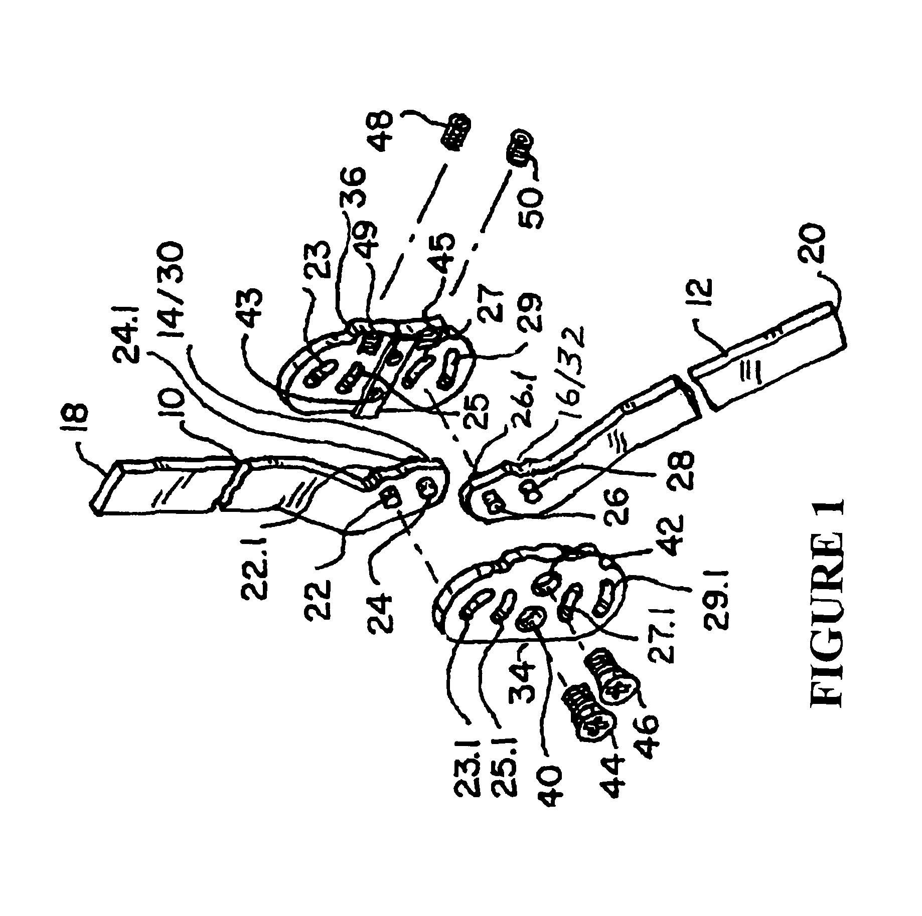 Multi-centric orthopedic hinge joint