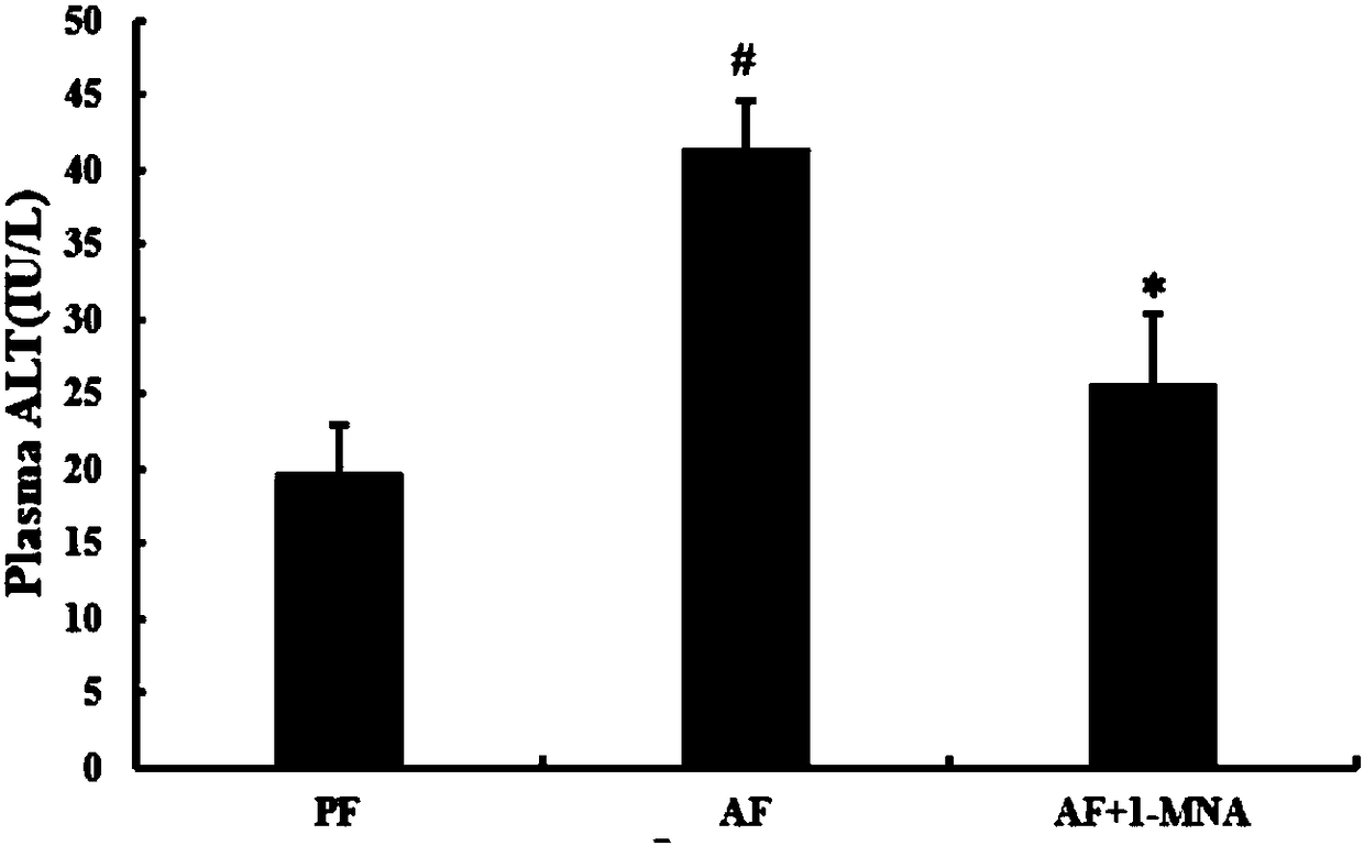 Application of 1-MNA (Methylnicotinamide) in preparing drug for preventing or treating alcoholic fatty liver