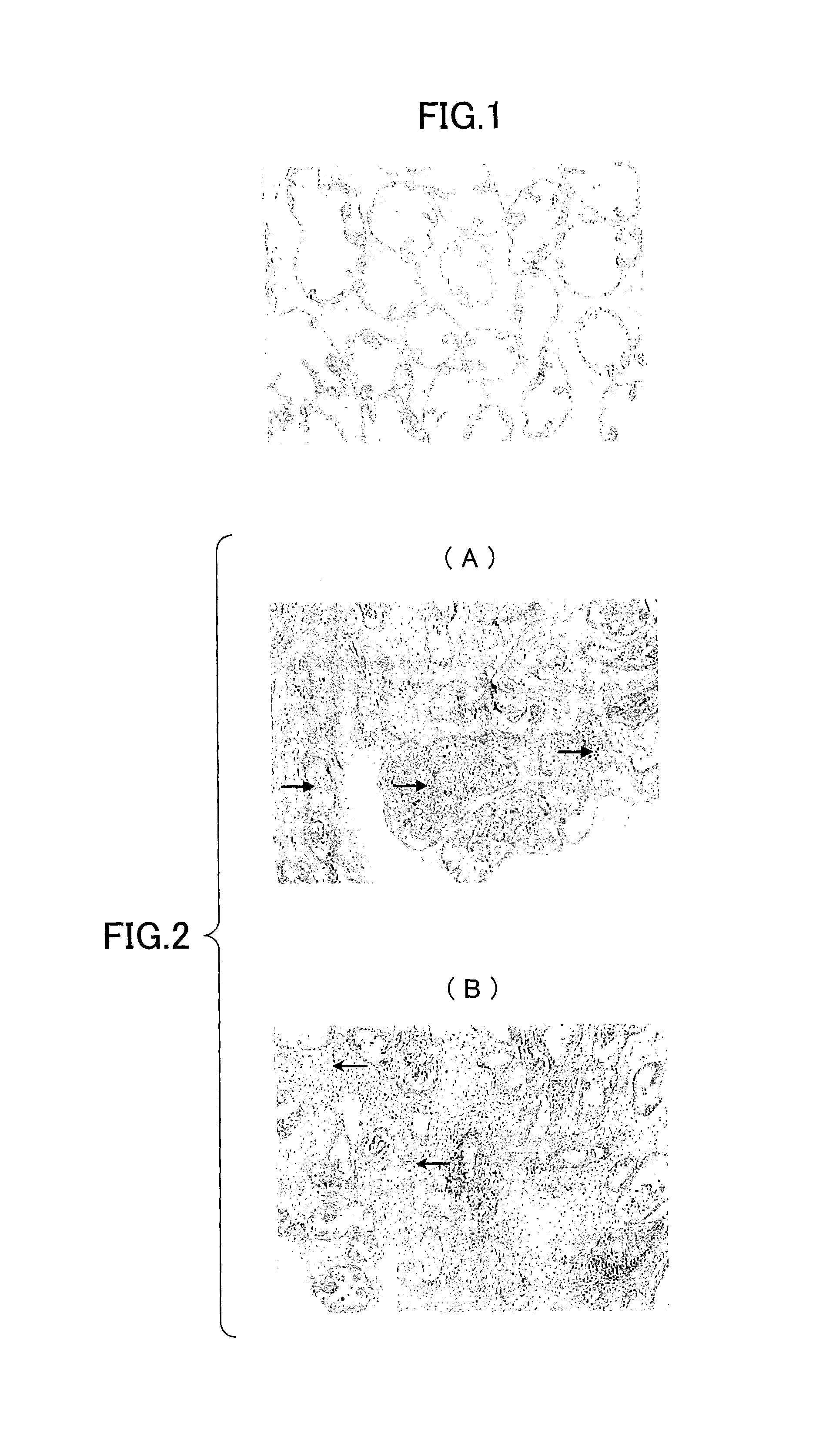 Therapeutic agent for a lower urinary tract disease and an agent for improving a lower urinary tract symptom