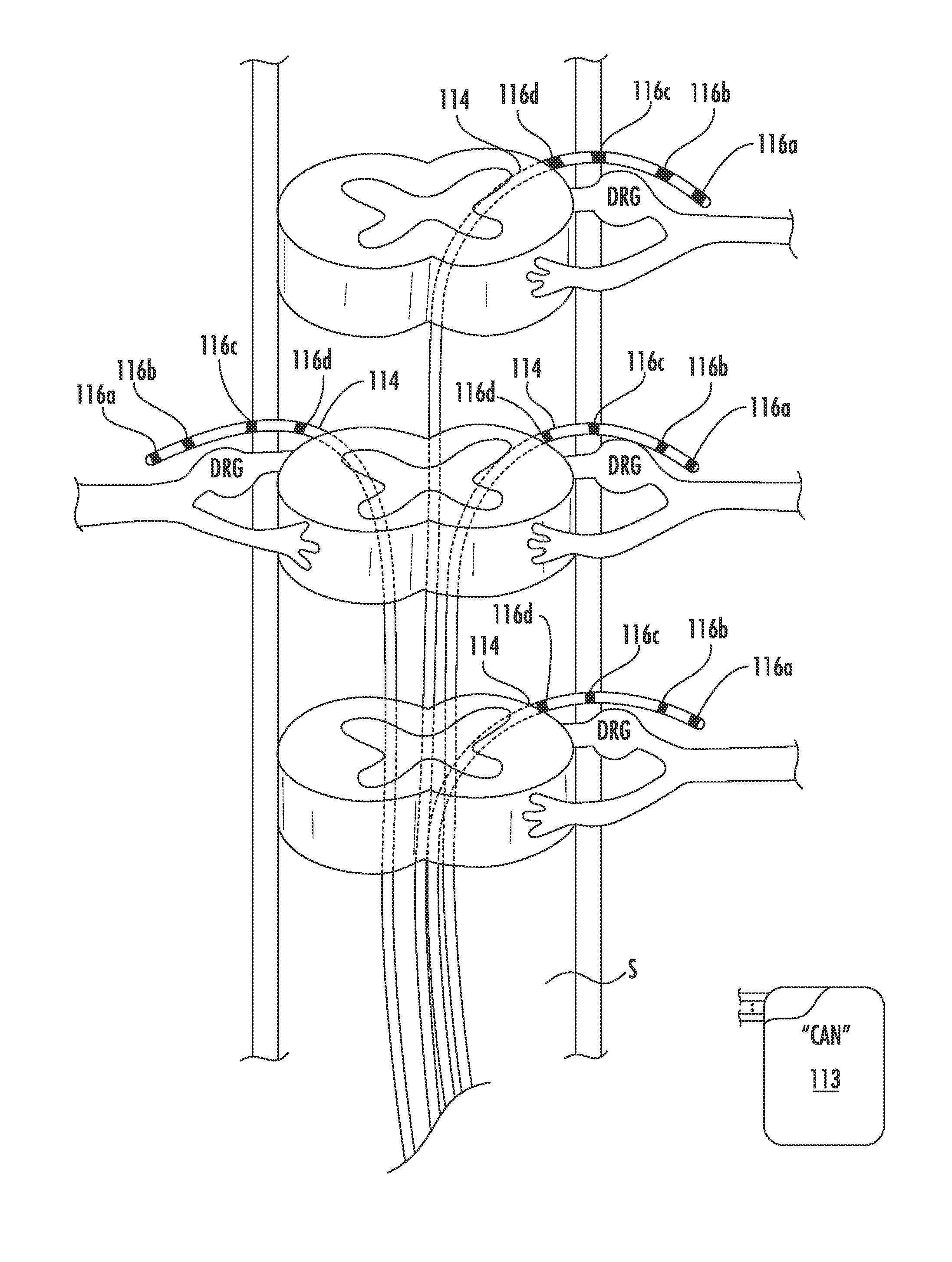 Methods and systems for automatically turning on and off DRG stimulation and adjusting DRG stimulation parameters