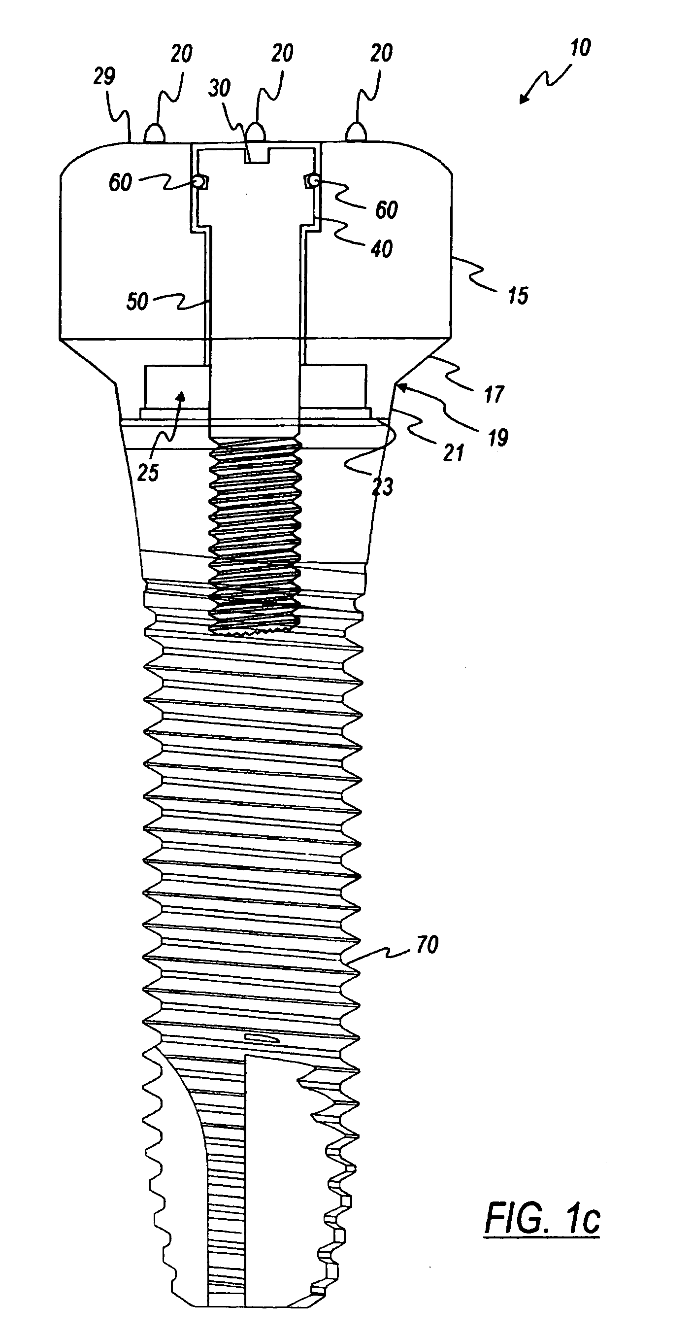 Healing components for use in taking impressions and methods for making the same