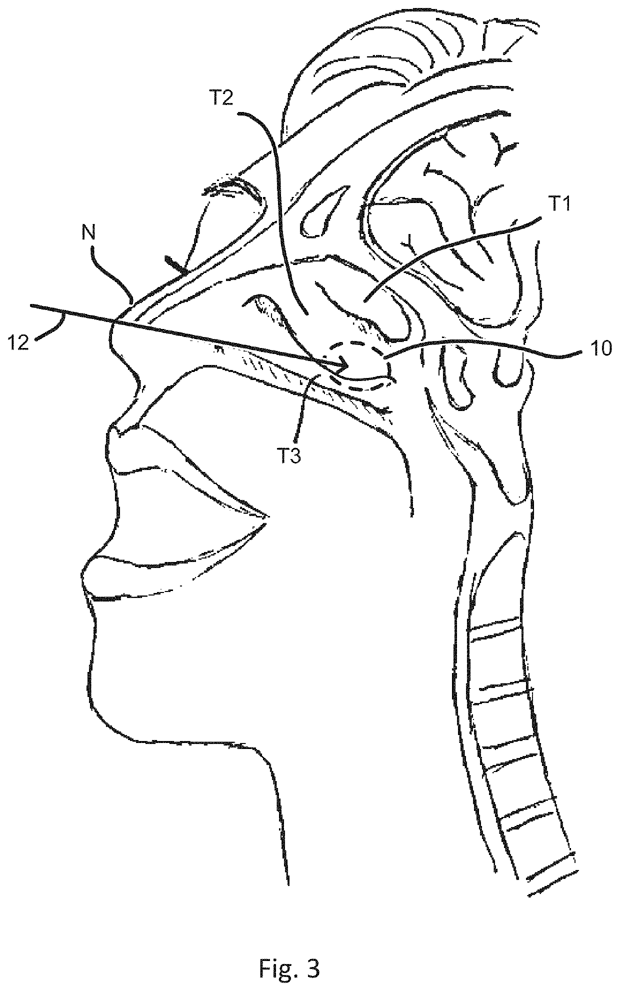 Devices and methods for treating a lateral surface of a nasal cavity