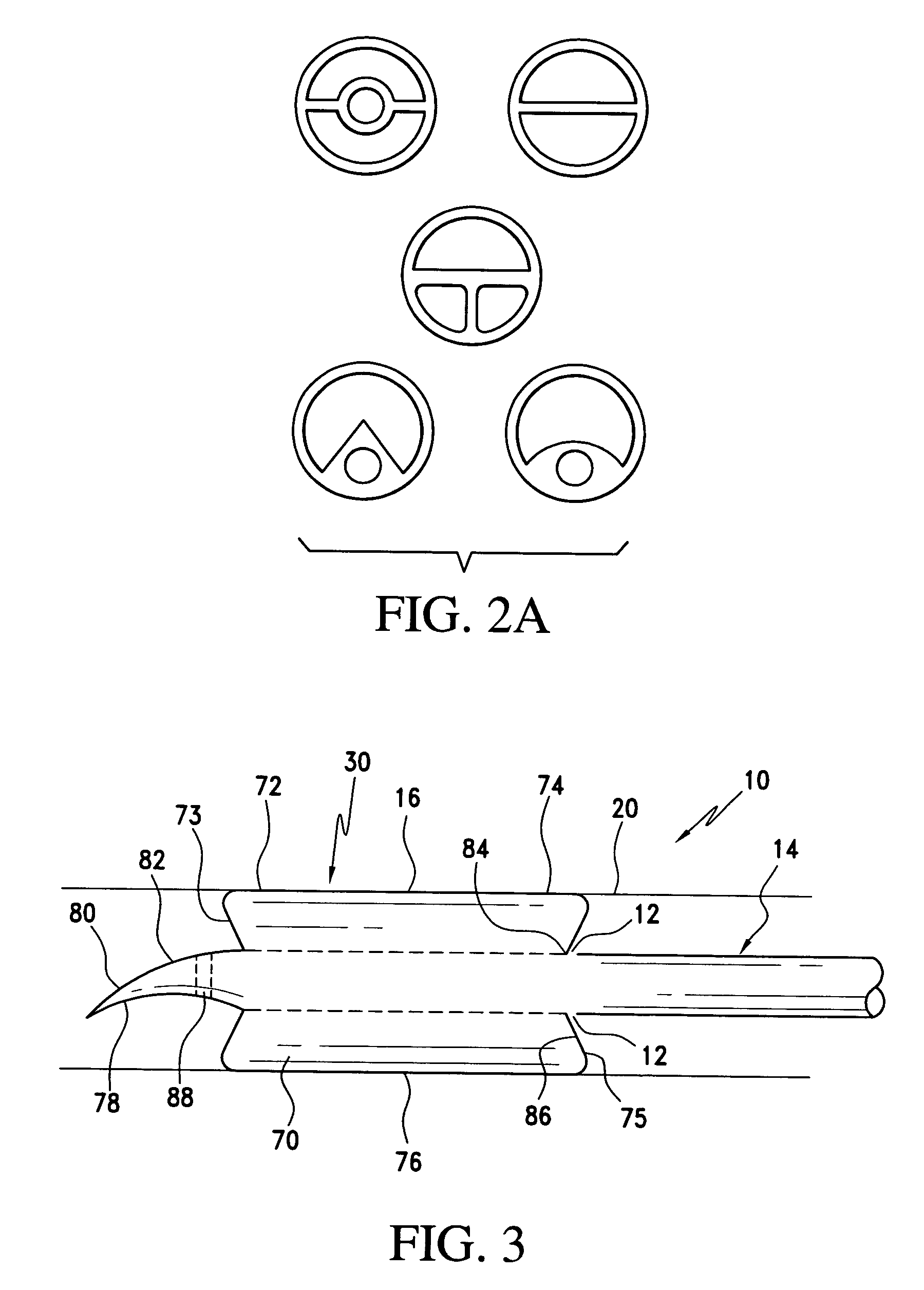 Method and apparatus for treatment of thrombosed hemodialysis access grafts