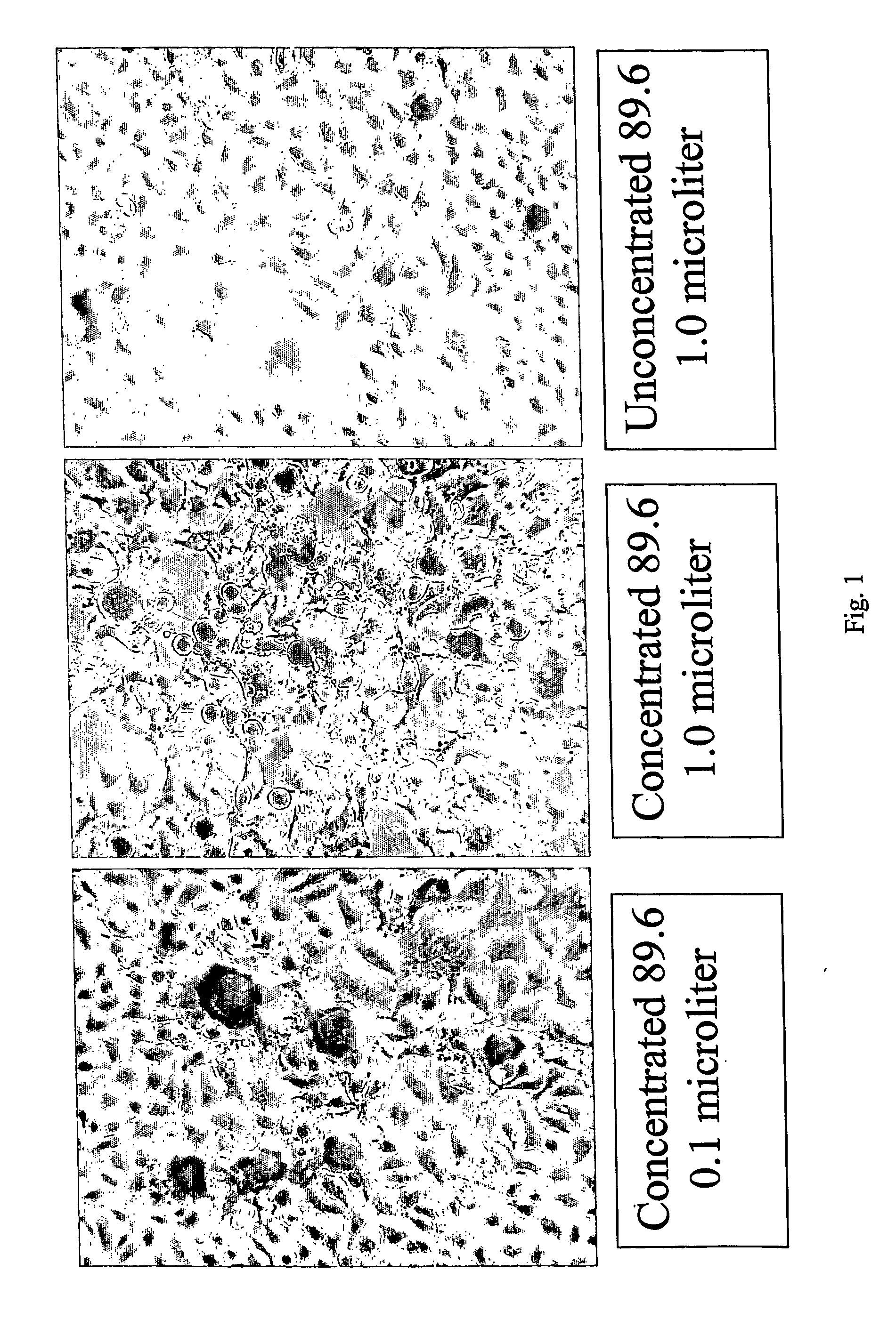 Methods of treatment and diagnosis using modulators of virus-induced cellular gene sequences