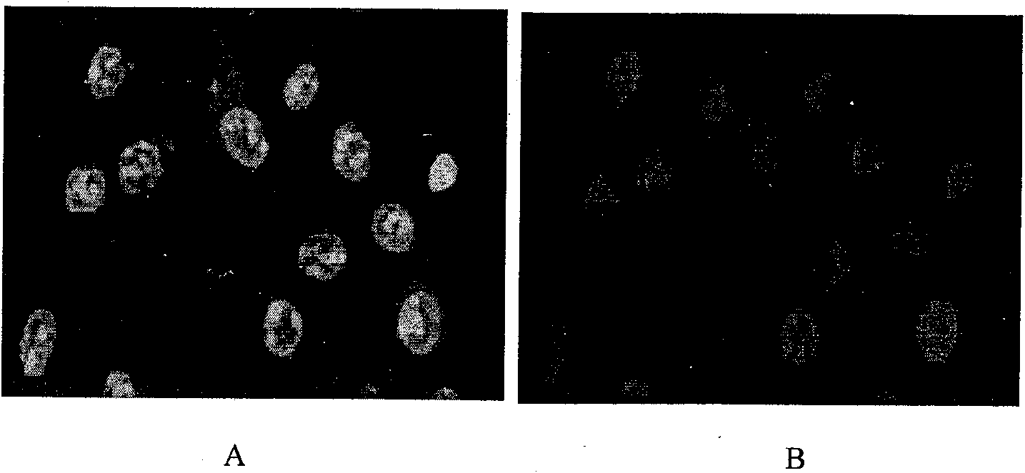 Synthesis method for subcellular organelle target directional Chitosan oligosaccharide-aliphatic acid grafting matter