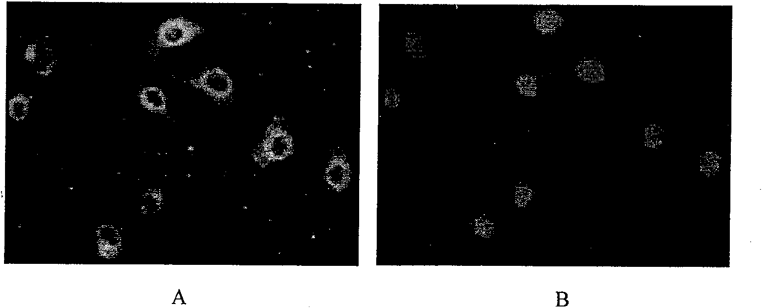 Synthesis method for subcellular organelle target directional Chitosan oligosaccharide-aliphatic acid grafting matter