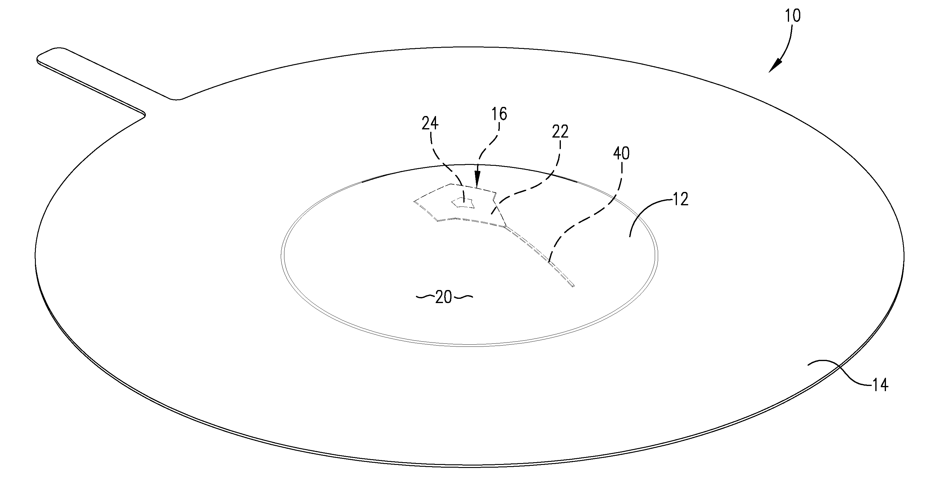 Rupture disc having laser-defined reversal initiation and deformation control features