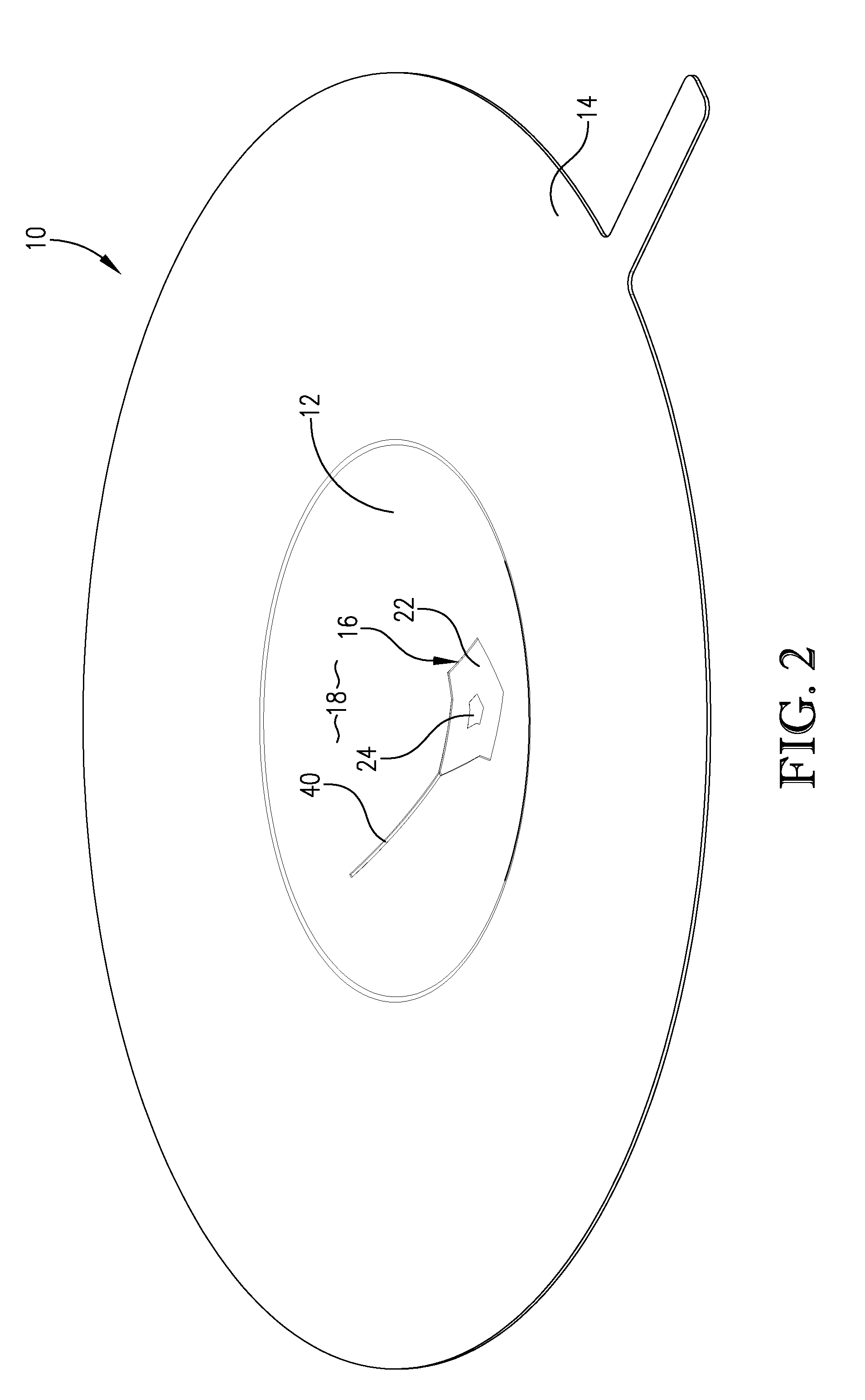 Rupture disc having laser-defined reversal initiation and deformation control features