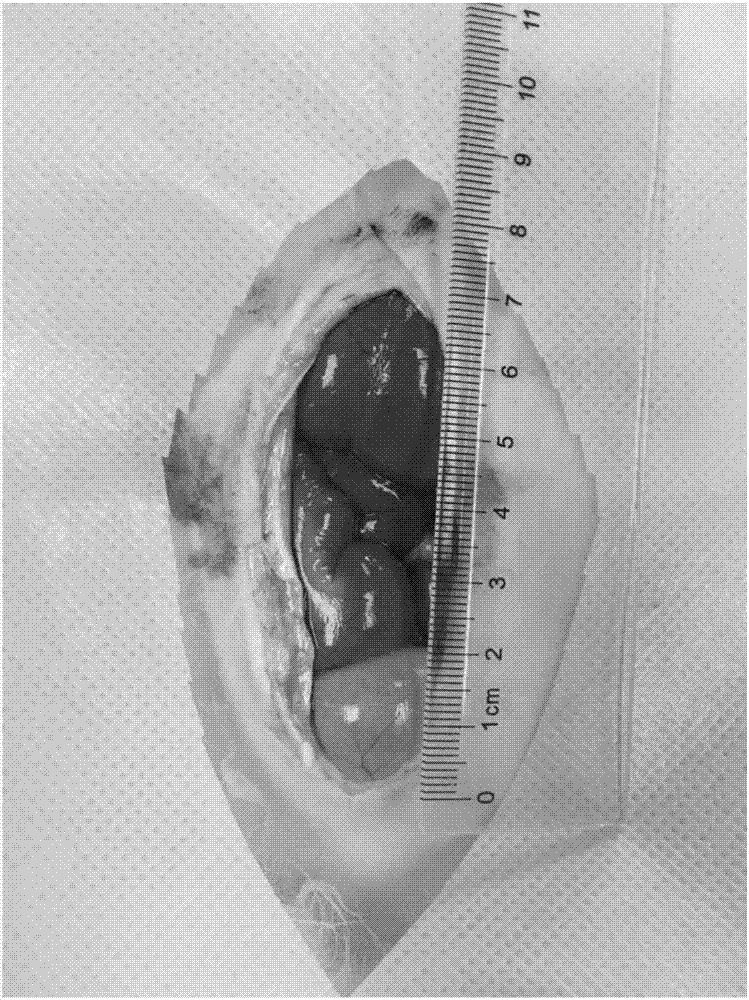 Modeling method for new blood vessels in abdominal aorta atherosclerotic plaques of New Zealand white rabbit