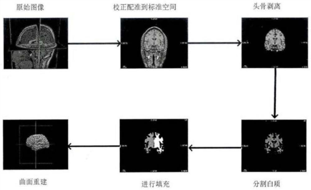 Locally linear embedding-based (LLE-based) early diagnosis method for Alzheimer disease, device and system