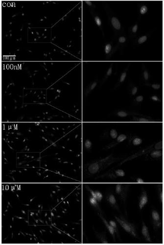 Preparation for conditional medium of umbilical cord mesenchymal stem cells for enhancing autophagy and application thereof in angiogenesis
