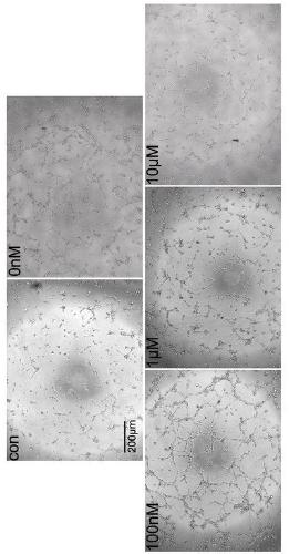 Preparation for conditional medium of umbilical cord mesenchymal stem cells for enhancing autophagy and application thereof in angiogenesis