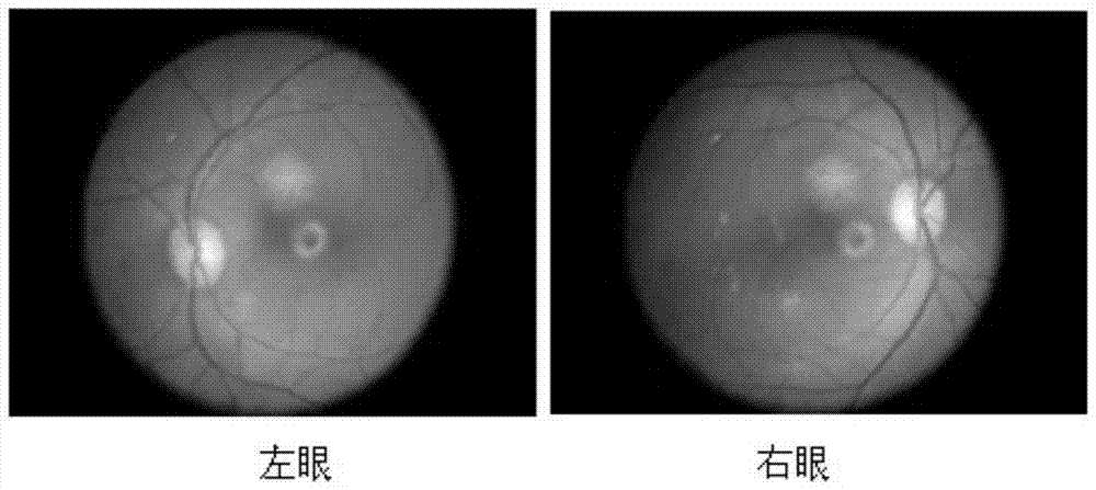 A method for high-fat induced primate macular degeneration model