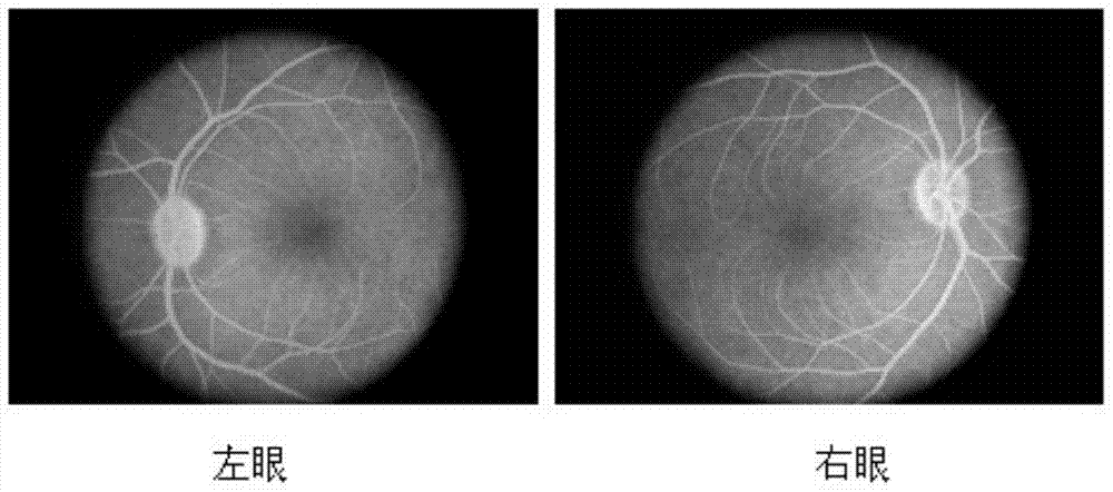 A method for high-fat induced primate macular degeneration model