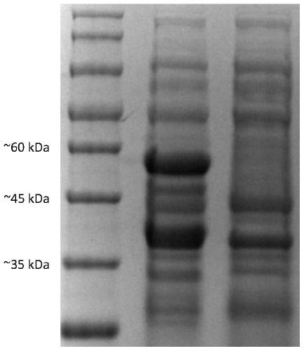 Preparation and application of cryptosporidium protein kinase 660 C-terminal protein