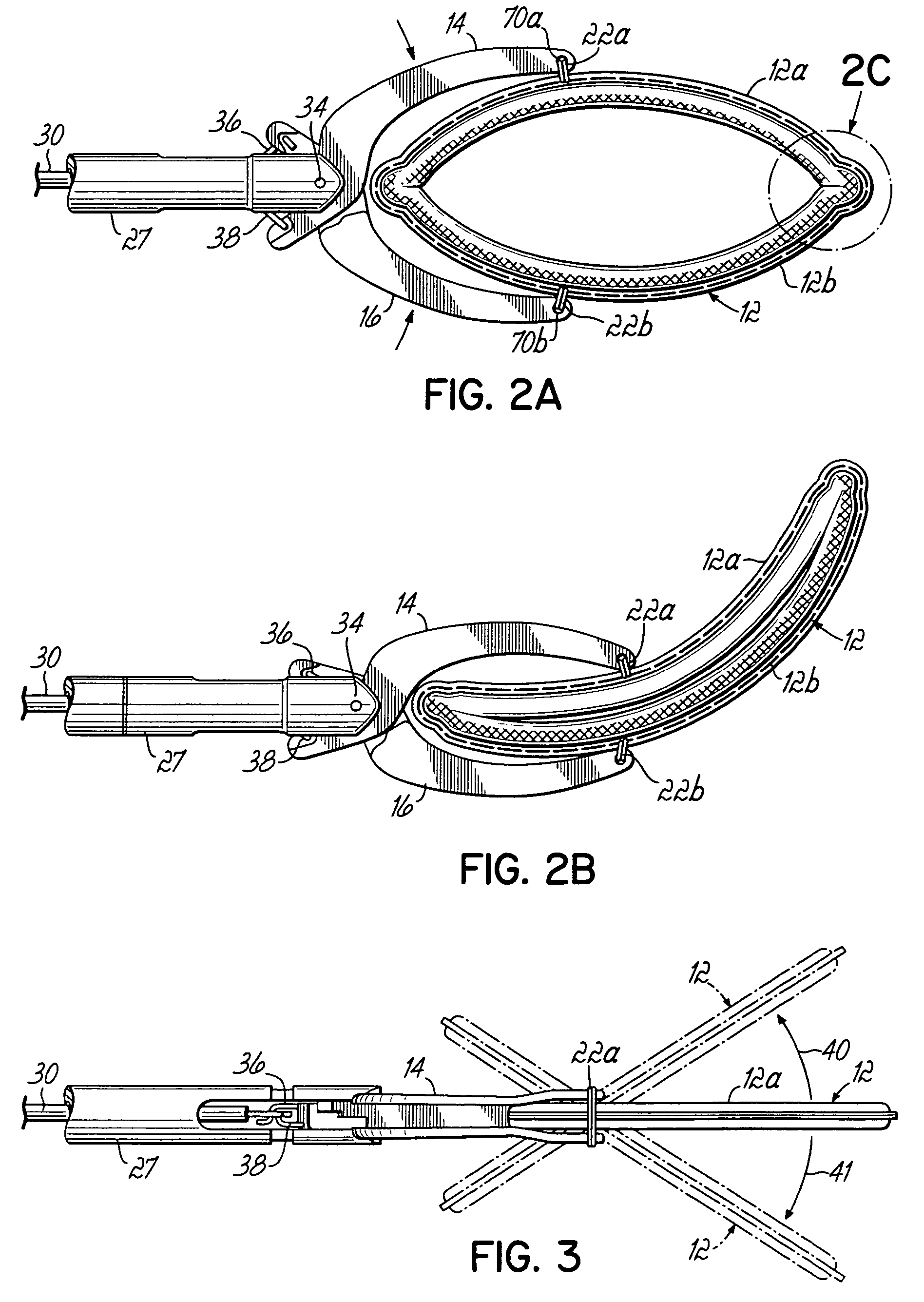 Apparatus and methods for occluding a hollow anatomical structure