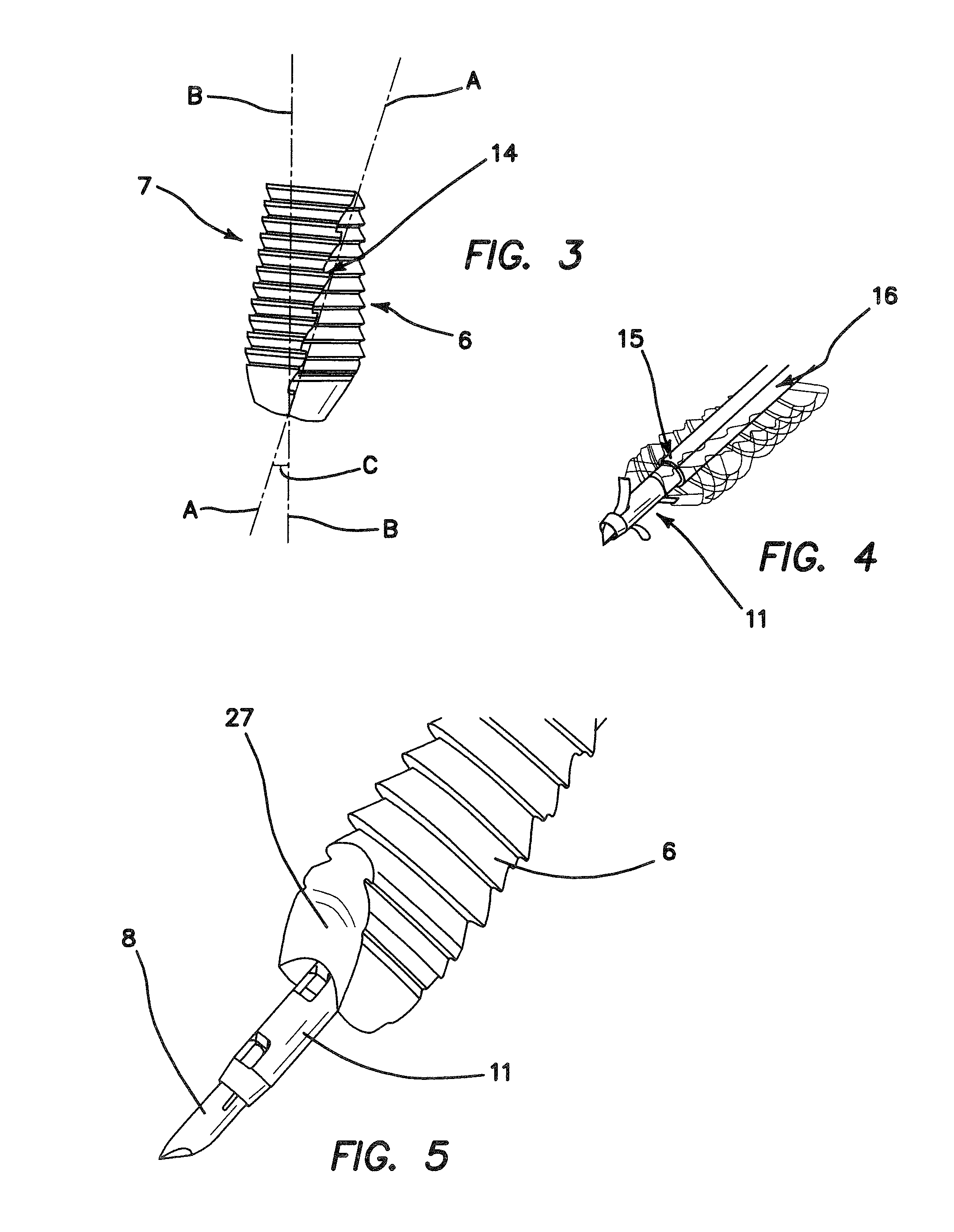 Tenodesis implant and inserter and methods for using same