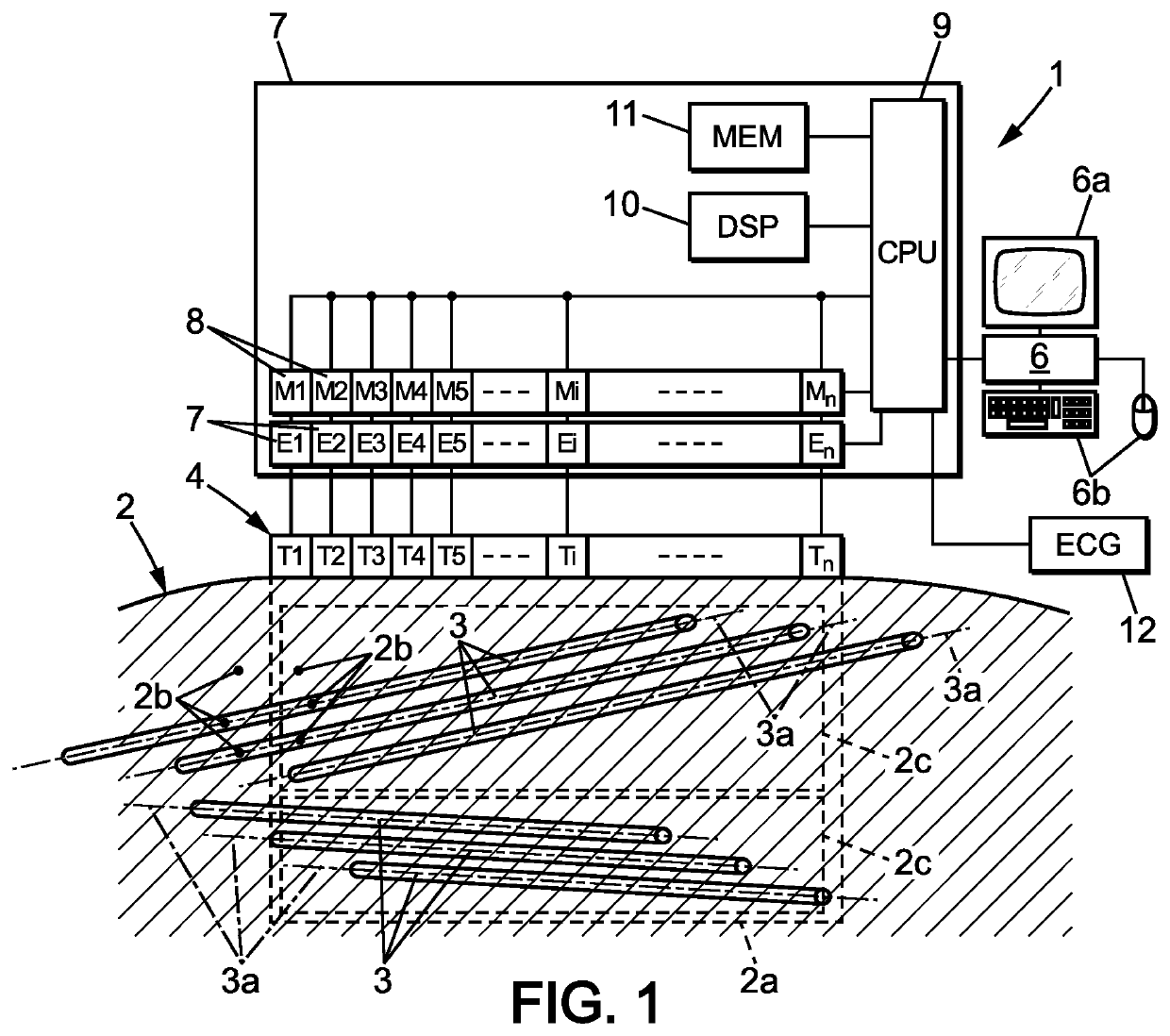 Shear wave elastrography method and apparatus for imaging an anisotropic medium