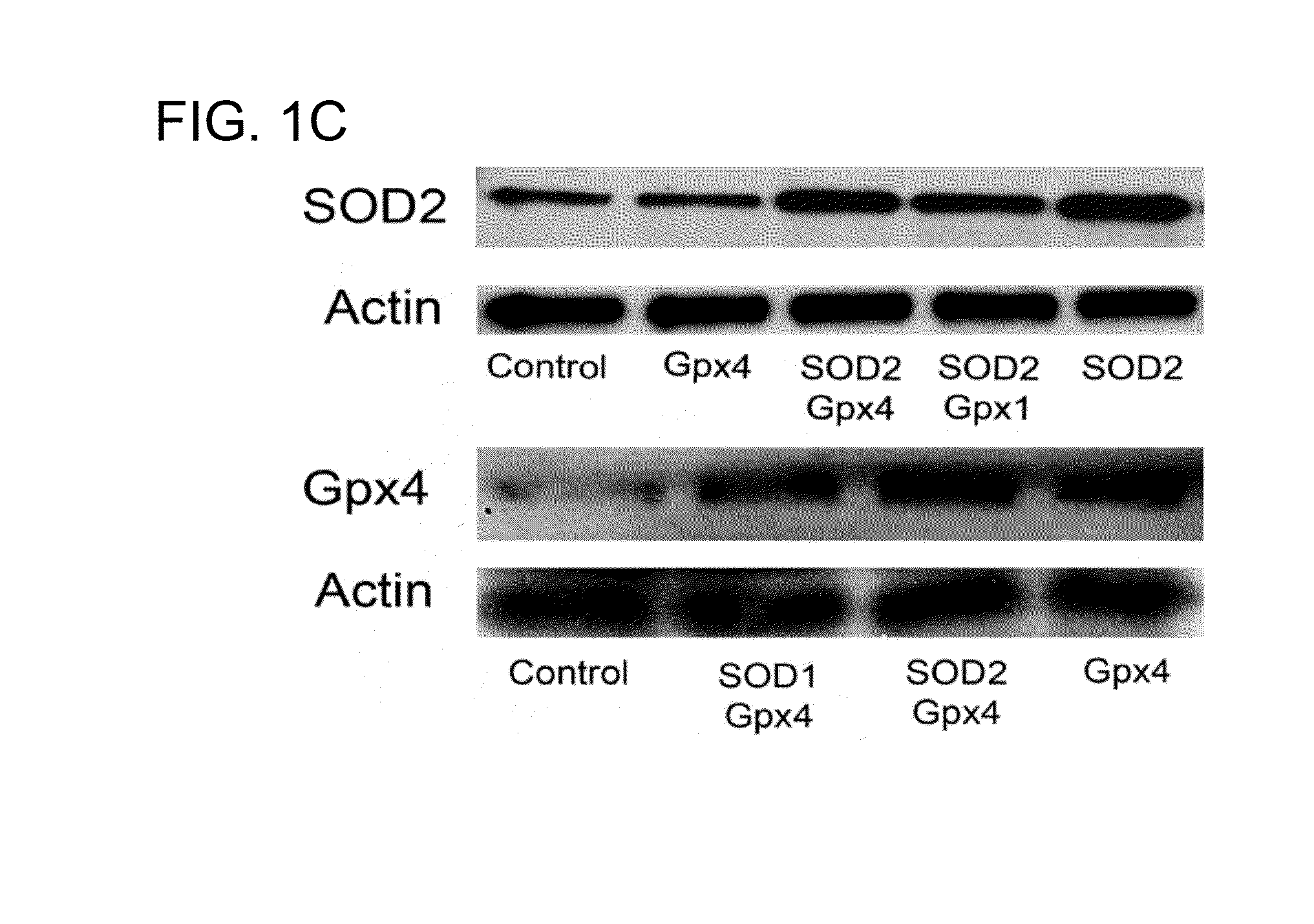 Compositions and methods for the treatment of ocular oxidative stress and retinitis pigmentosa
