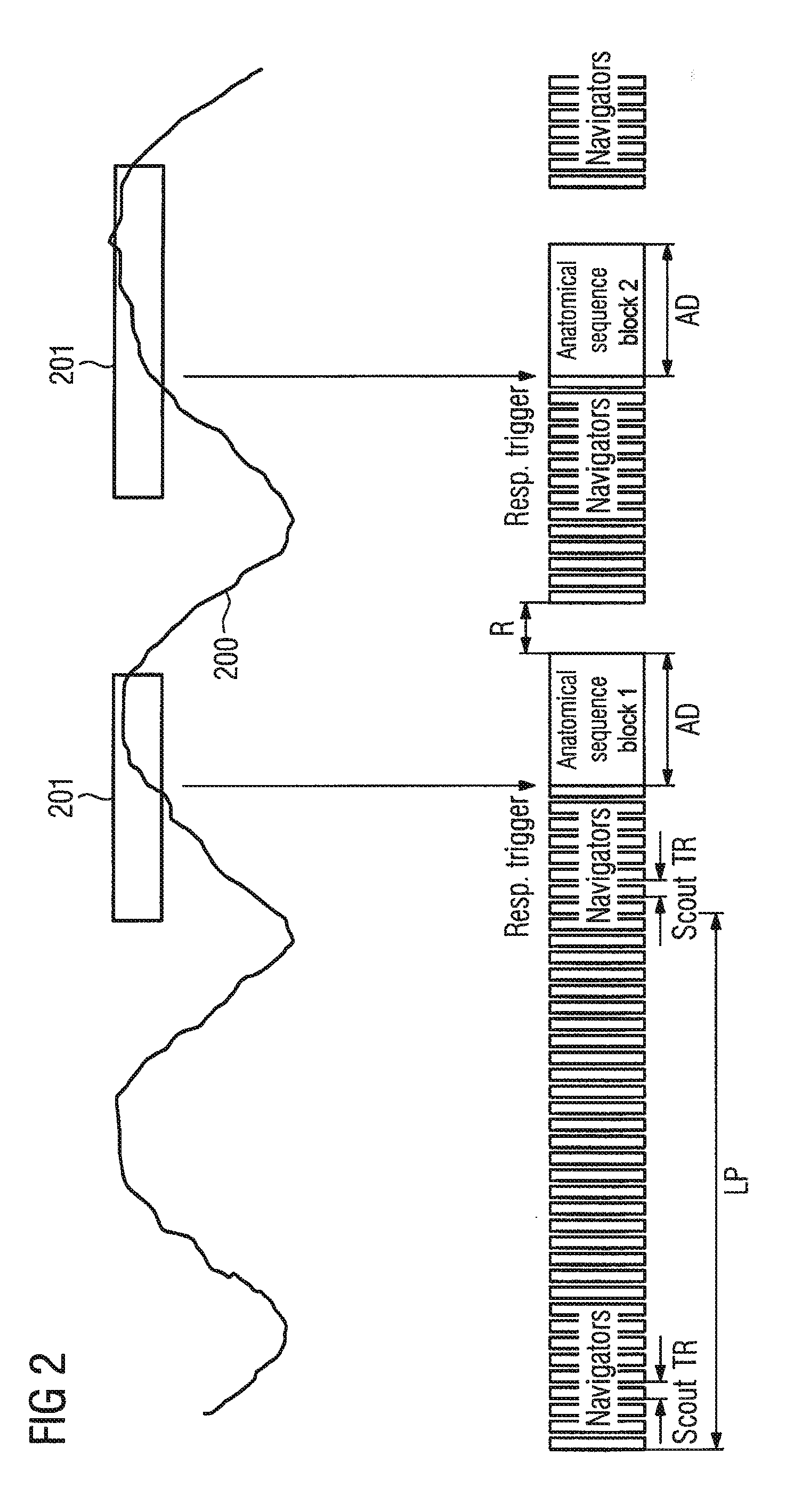 Method to acquire measurement data of a breathing examination subject by magnetic resonance technology, and associated computer program