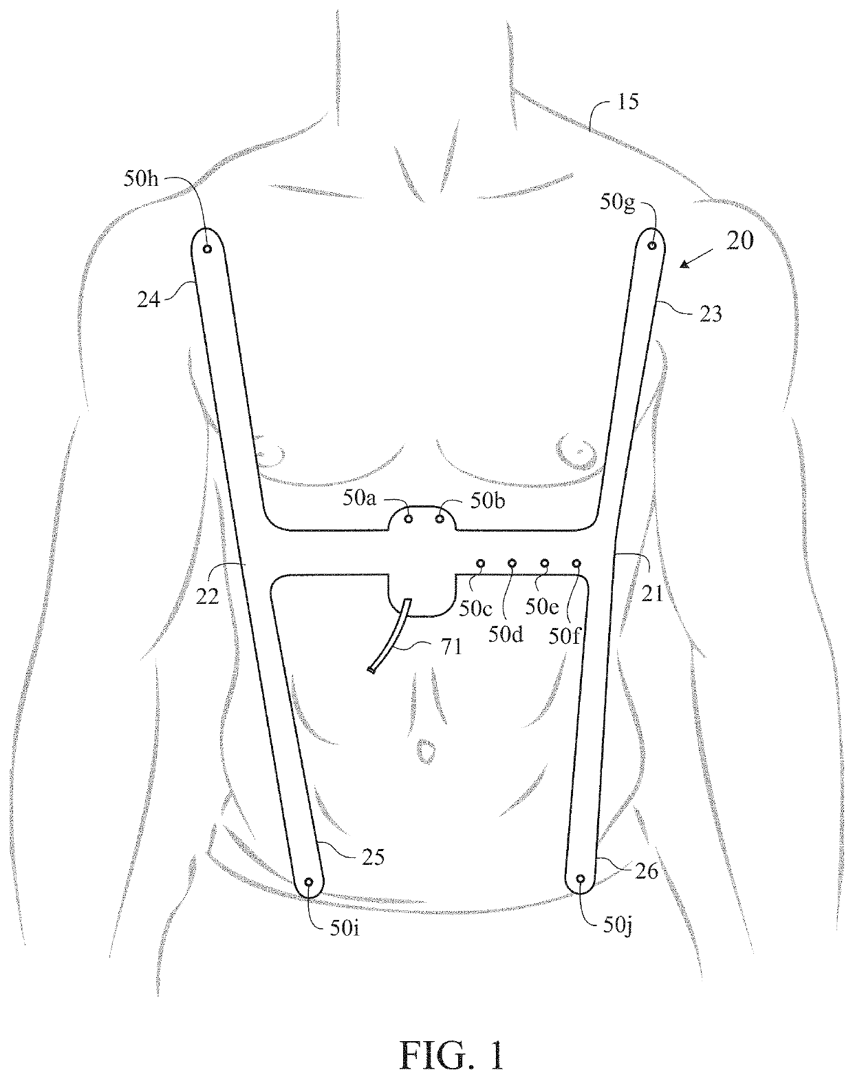 Emergency cardiac and electrocardiogram electrode placement system