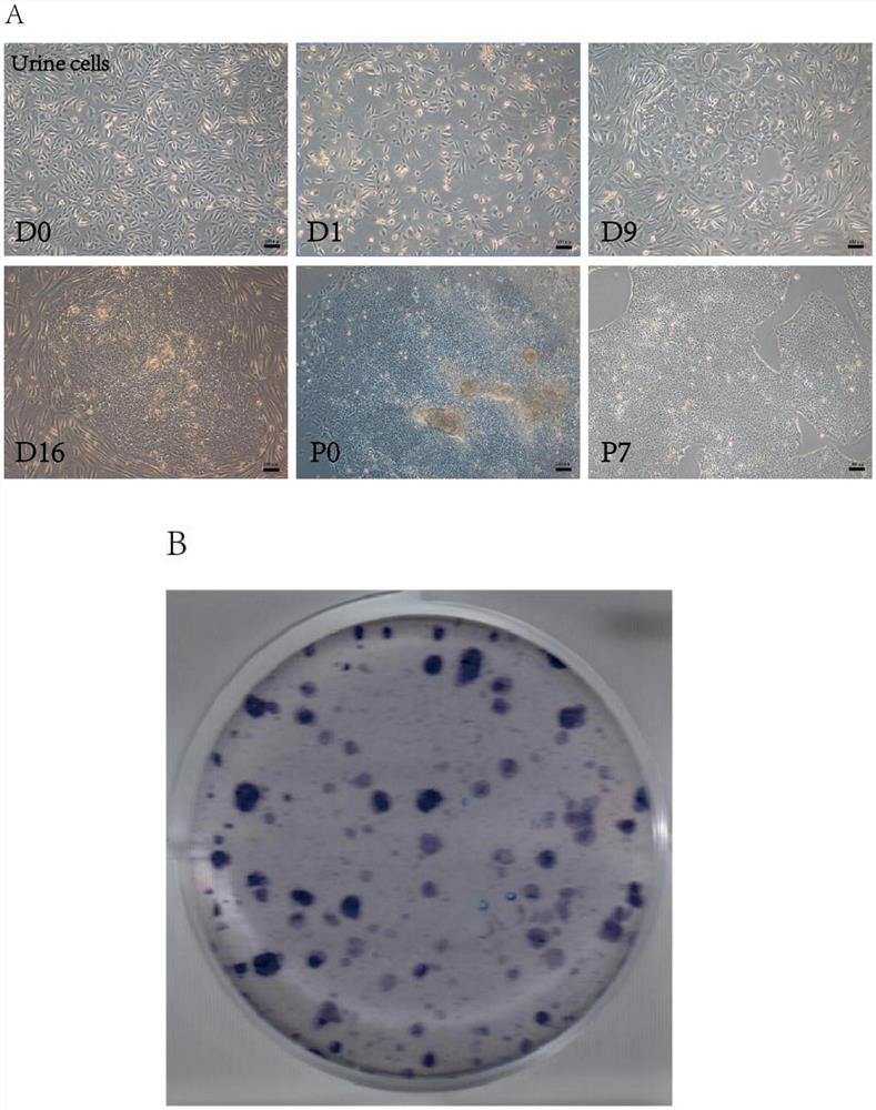 Human induced pluripotent stem cell as well as preparation method and application thereof