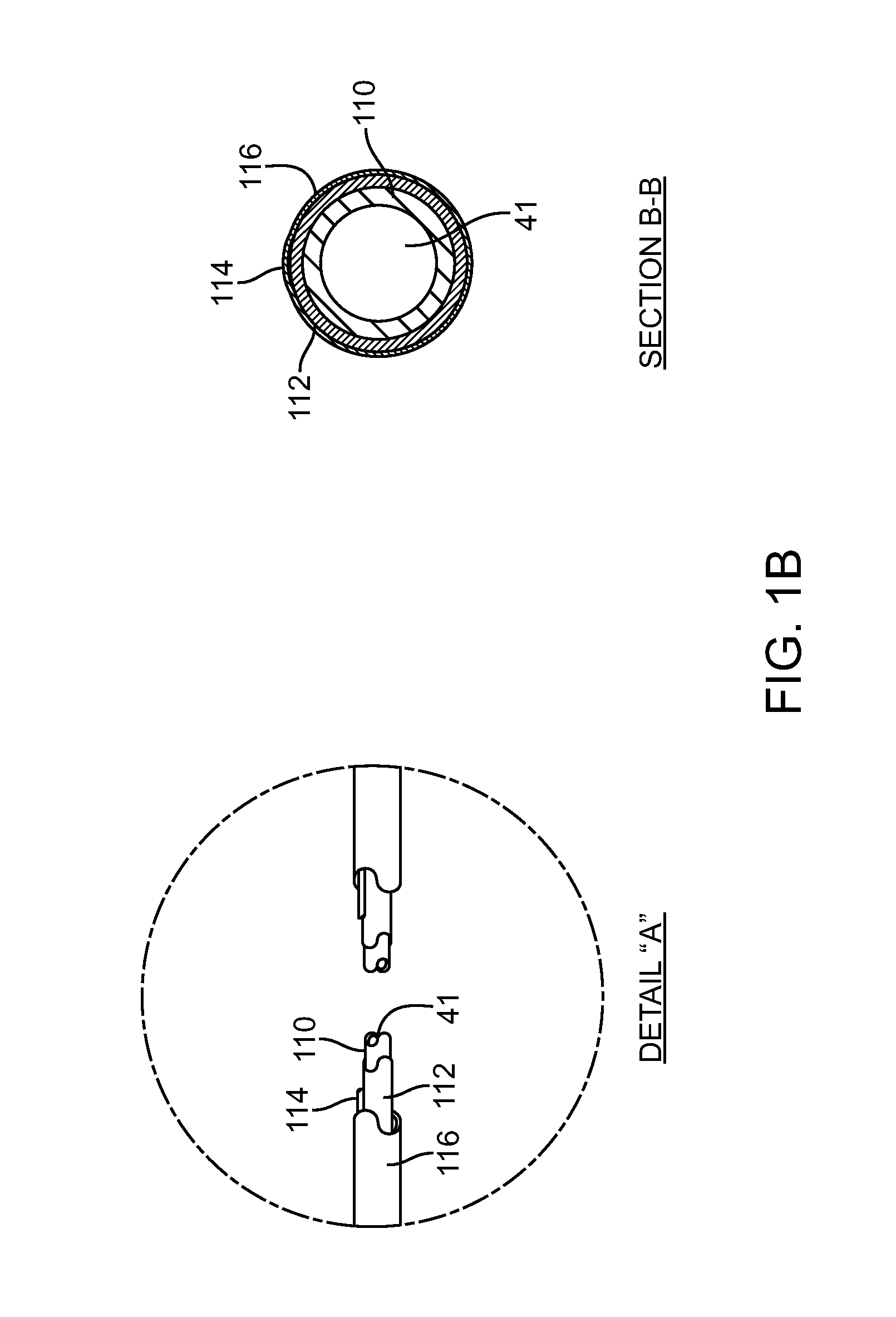 Irreversible electroporation device and method for attenuating neointimal formation
