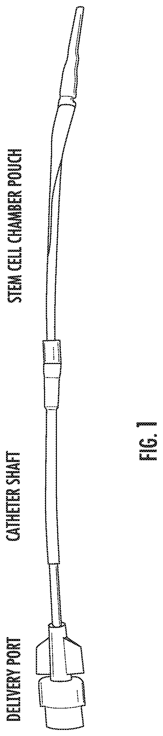 Implantable bioreactor and methods for making and using same