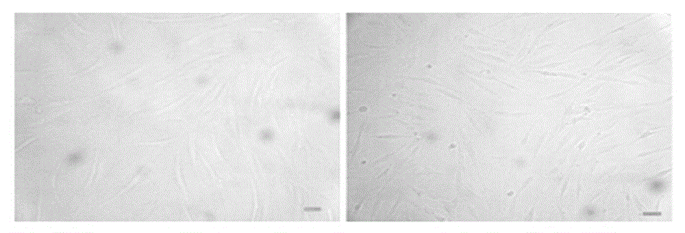 Application of progesterone in stimulation of fibronectin secretion of mesenchymal stem cells