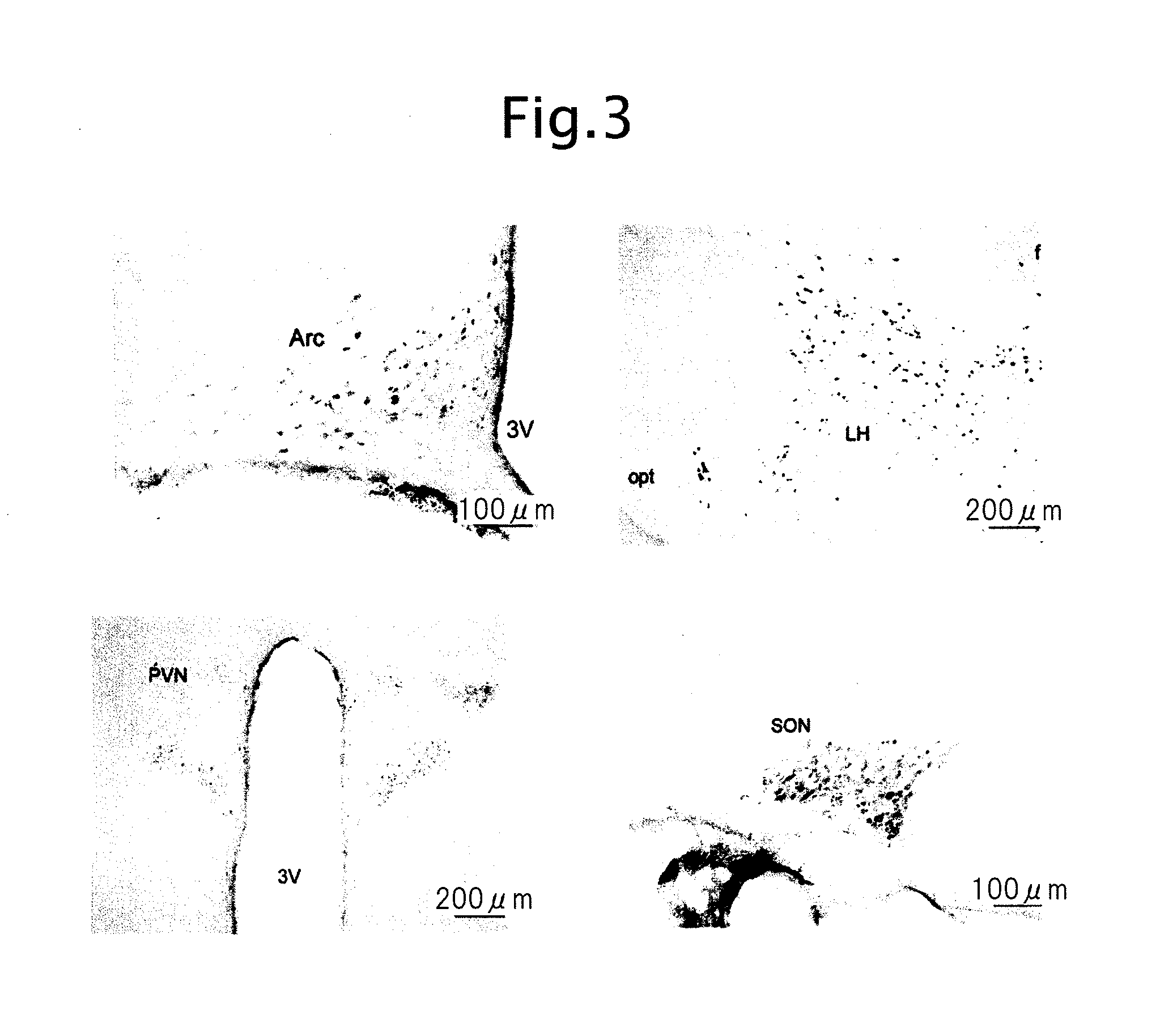 Novel biological substance nesfatin and its related substances and uses thereof