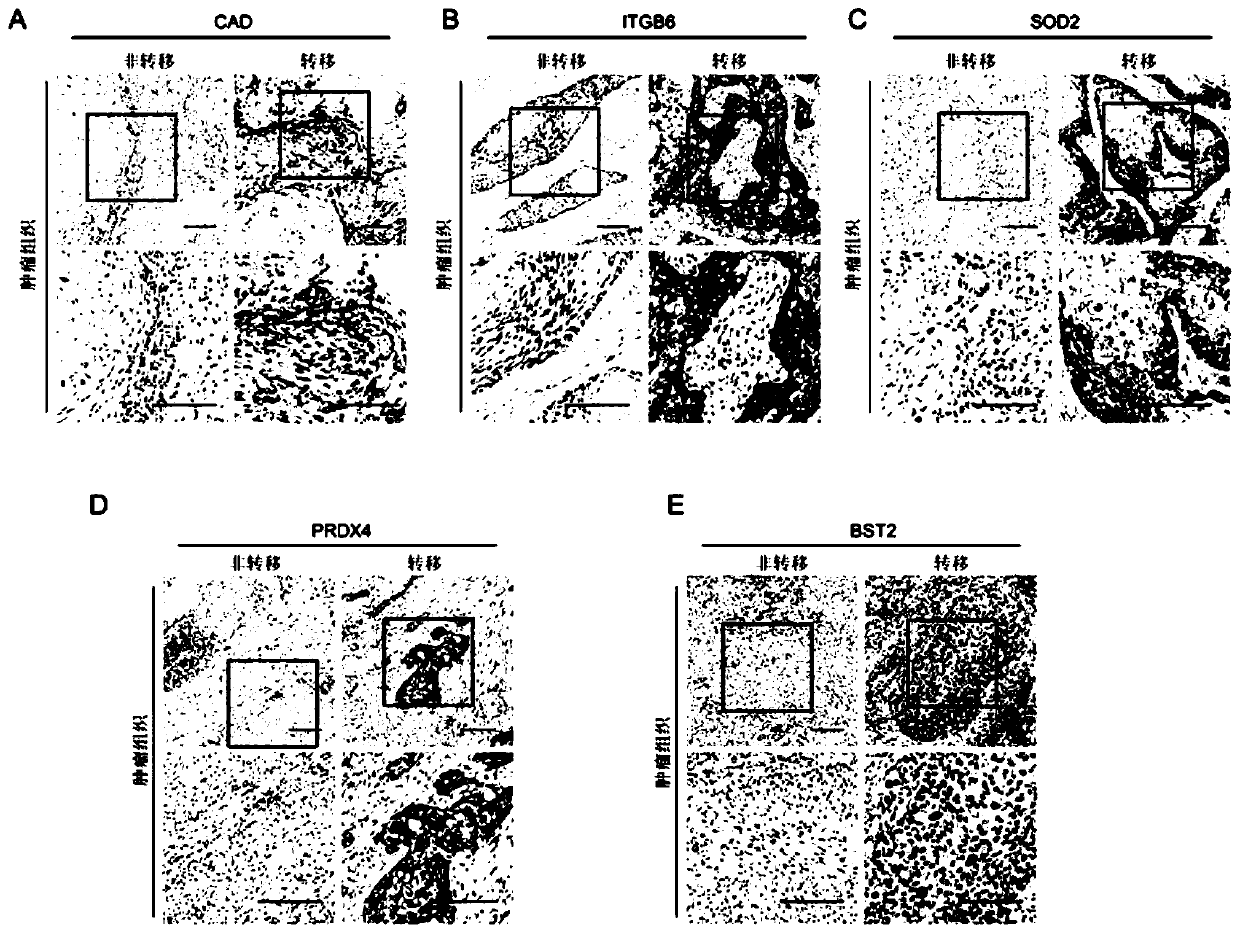 Composition as well as kit, biochip and application thereof