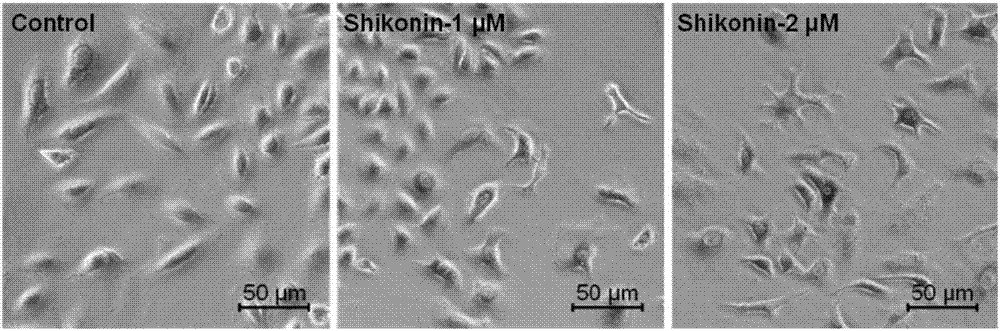 Application of shikonin in preparing drug for treating lung cancer