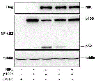 Application of NIK protein kinase inhibitor in serving as medicine for treating liver diseases