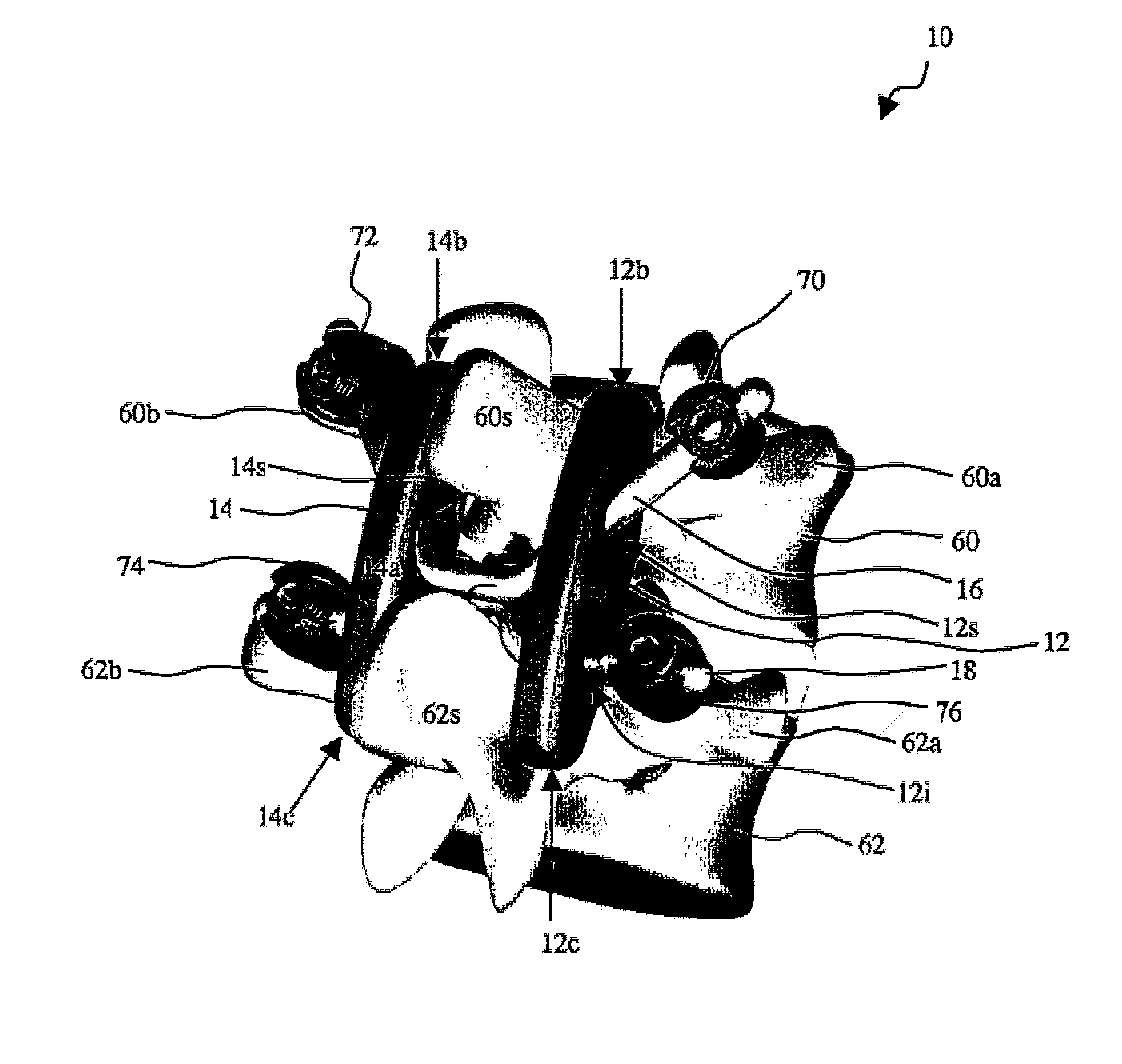Posterior dynamic stabilizer devices
