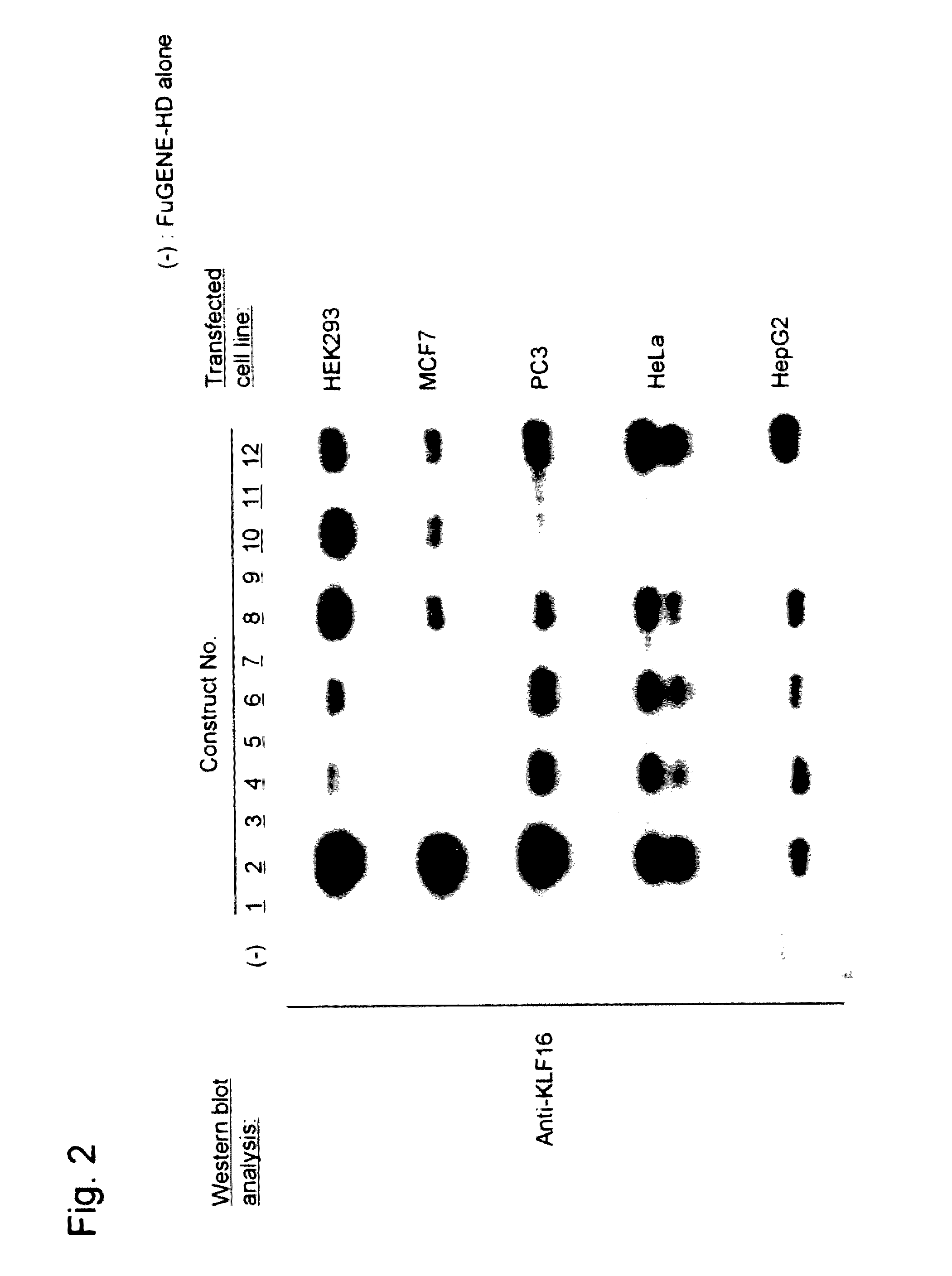 System for increasing gene expression and vector comprising the system