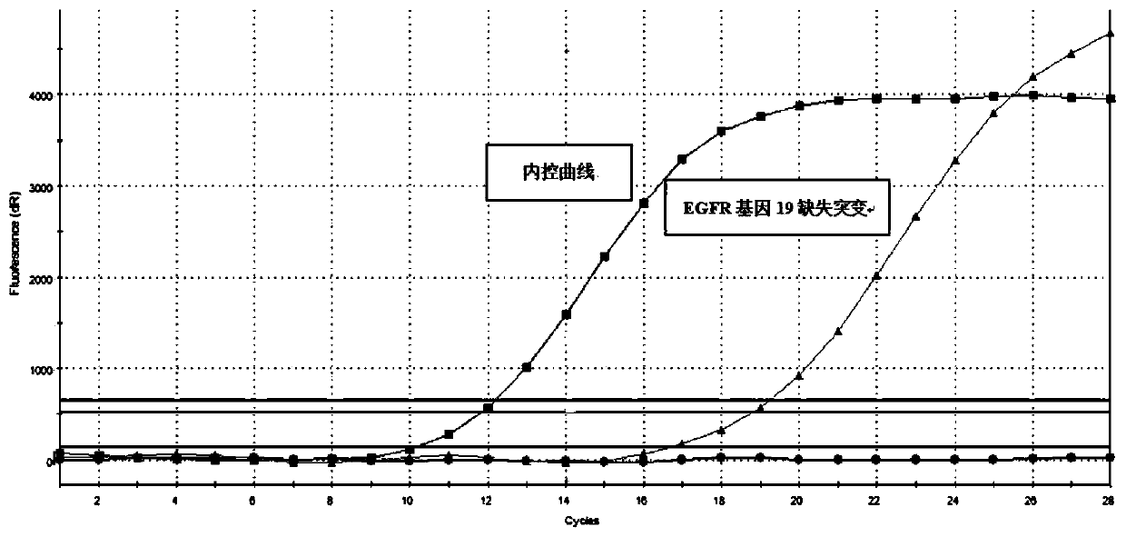 Method for extracting cfDNA in sputum sample