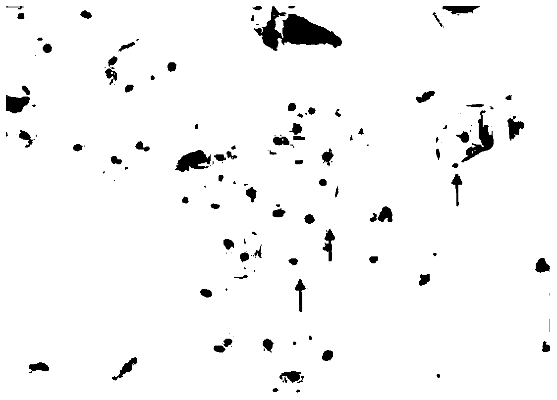 Method for extracting cfDNA in sputum sample