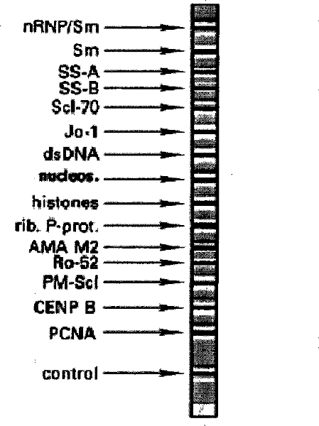 Reagent kit for detecting autoimmunity disease related antinuclear antibodies spectrum and preparation method thereof