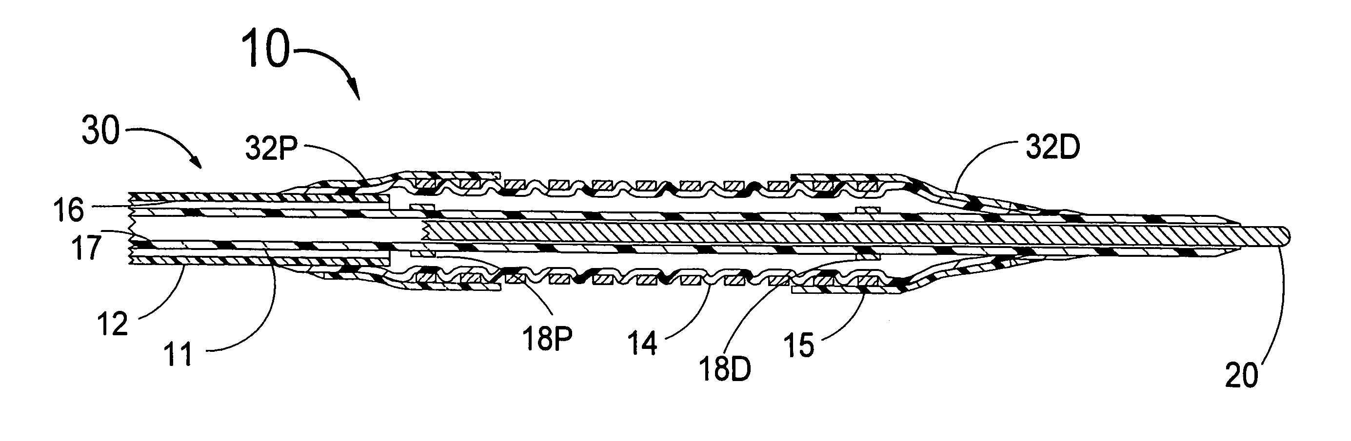 Stent with self-expanding end sections