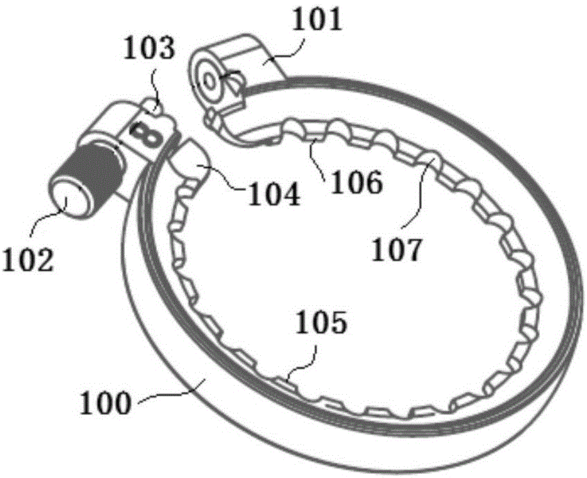 Foreskin ligation device capable of avoiding postoperative edema