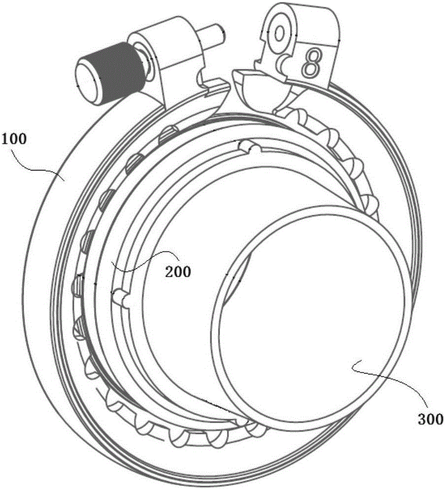 Foreskin ligation device capable of avoiding postoperative edema