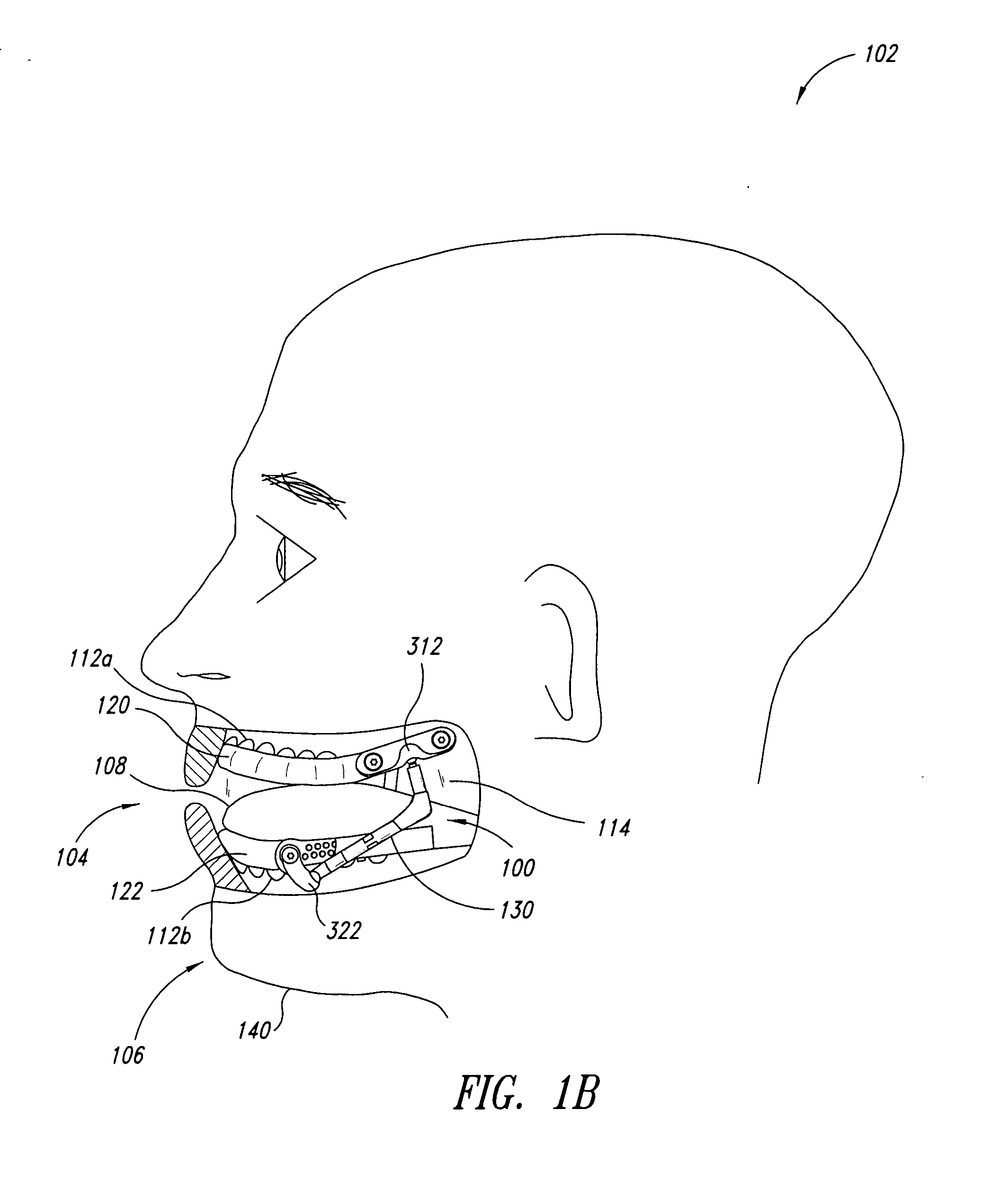 Dental orthotic and methods of using the same