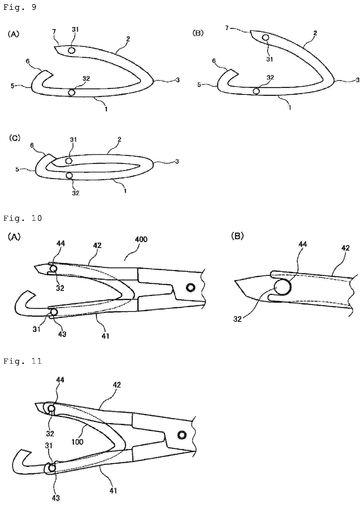 Organ resection stump fixing clip