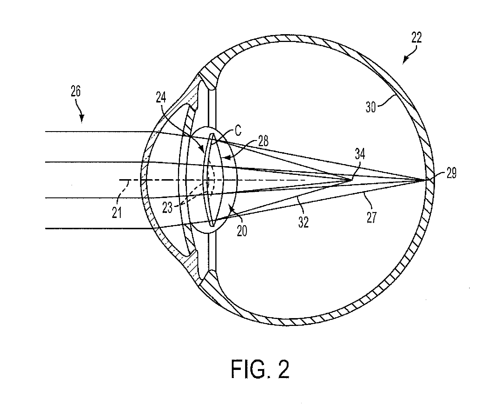 Multifocal lens having an optical add power progression, and a system and method of providing same