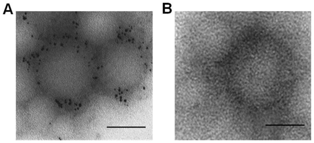 A preparation method for actively targeting biofilm nano-preparation