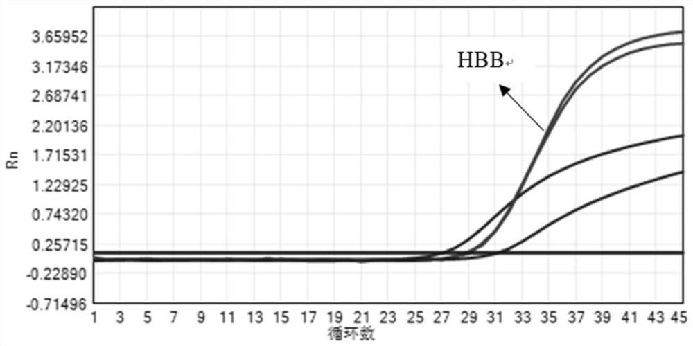 RT-PCR method for overspeed detection of trichomonas vaginalis