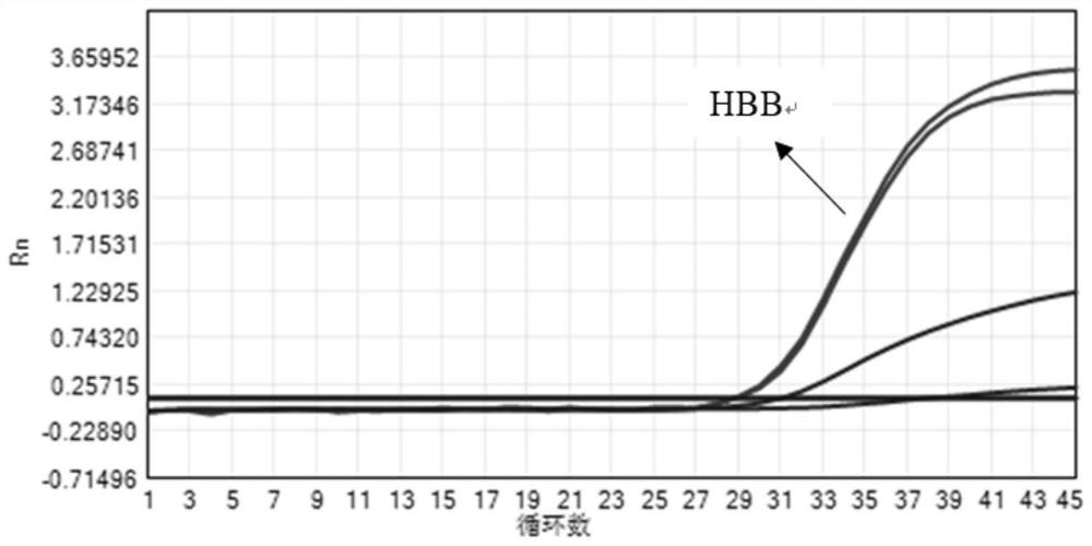 RT-PCR method for overspeed detection of trichomonas vaginalis