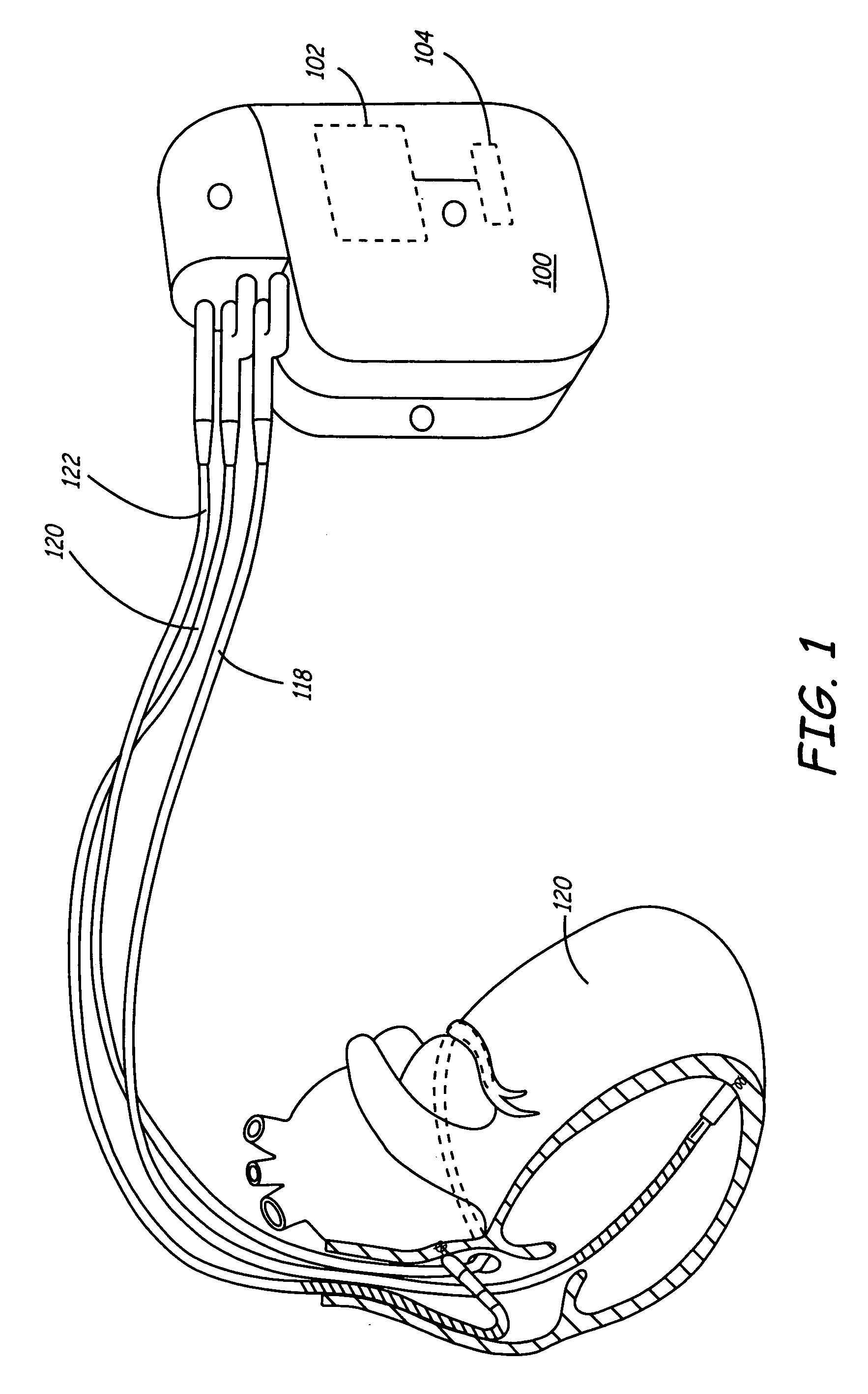 Method and apparatus for assessing ventricular contractile status